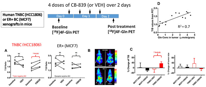 Molecular Imaging Markers for Glutaminolysis in Breast Cancer - 18FGIn Results